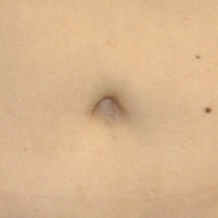 belly button shapes